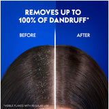 LADOR ANTI-DANDRUFF SHAMPOO - 530 ML